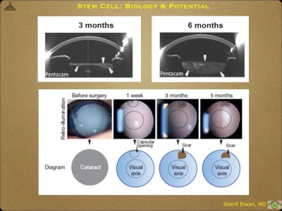 Pathology - Stem Cell.034.jpeg