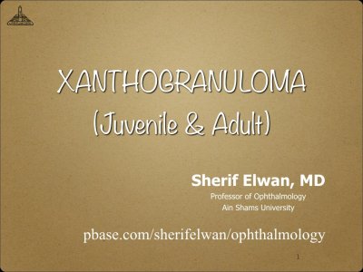 Adult Xanthogranuloma