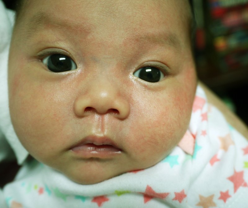 3 weeks old