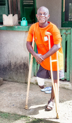 Leprosy Survivor