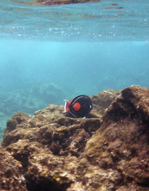 Achilles tang (I believe)