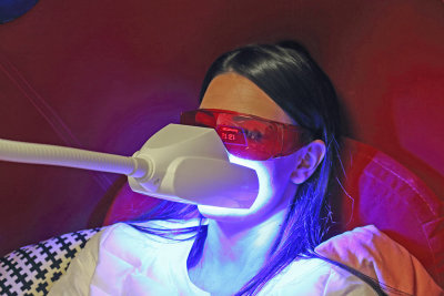 Whitening teeth beljenje zob_MG_0124-111.jpg