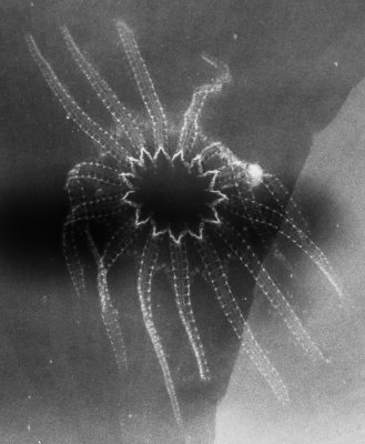 X-radiograph of Helianthaster rhenanus, 12 cm across, showing 14 arms, from the Devonian of Bundenbach