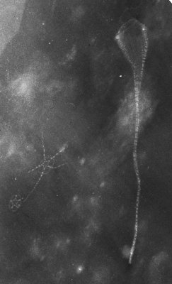 Retifungus rudens, 85 mm long, X-radiograph