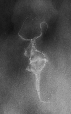 Regulaecystis pleurocystoides, 8 cm, X-radiograph