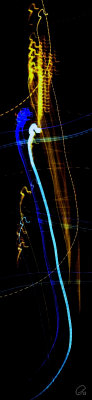 Spermatozoid
