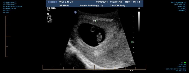US PREGNANCY 0002.jpg
