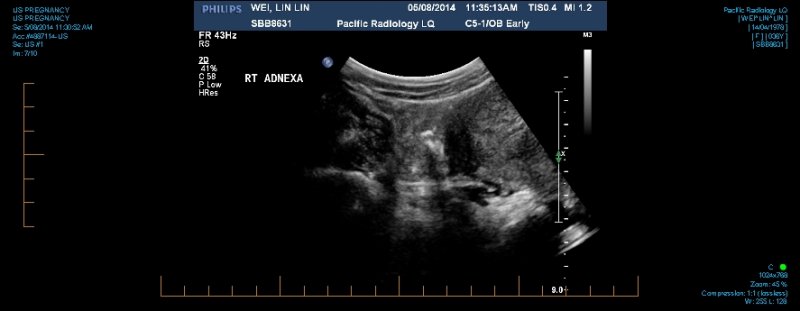 US PREGNANCY 0007.jpg