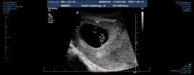 US PREGNANCY 0002.jpg