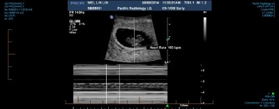 US PREGNANCY 0003.jpg