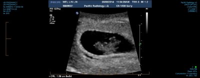 US PREGNANCY 0005.jpg