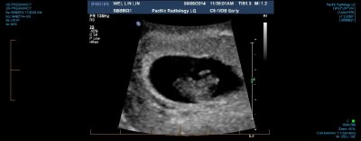 US PREGNANCY 0006.jpg
