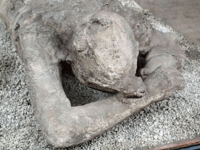 Head and hands of the mummy at the moment of death at Pompeii