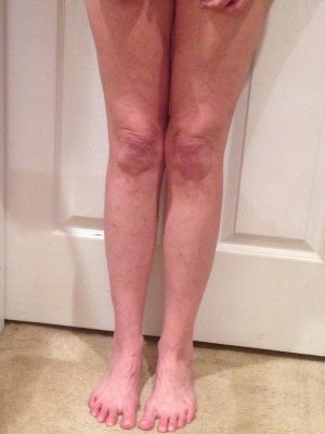 knees - legs together front  - one is higher - 11-23-14 .jpg