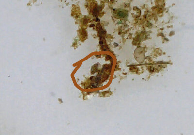 Microscopic Insect or Crustacean in a Farm Pond with Video