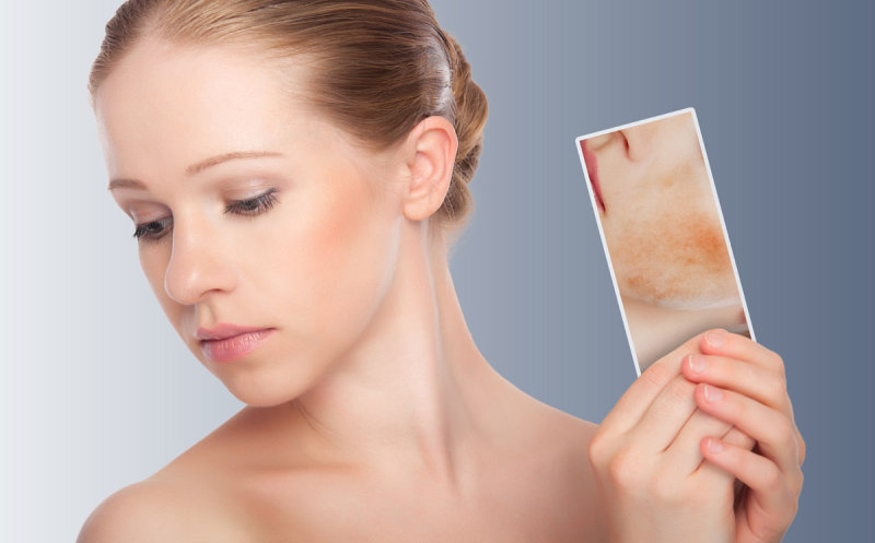 Skin Rejuvenation in Adelaide for a Young and Healthy Look