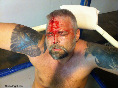 biker man fighting cut bleeding bloody.jpg
