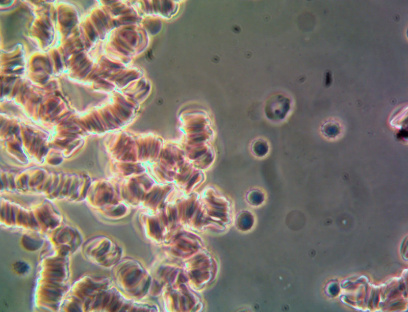my blood 100x Ph4.jpg