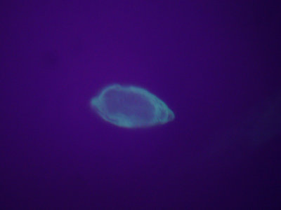 parasite on mosquito eater wing 40x fluorescence.jpg