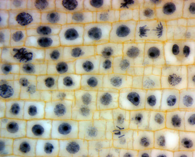 onion mitosis 60x PlanApo oil BF stacked.jpg