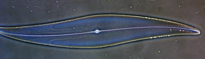 Carolina Biological test diatom #6 40x Ph3.jpg