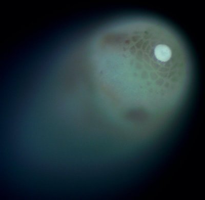 10x lacewing egg DF.jpg