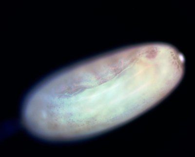 10x lacewing egg DF 3.jpg