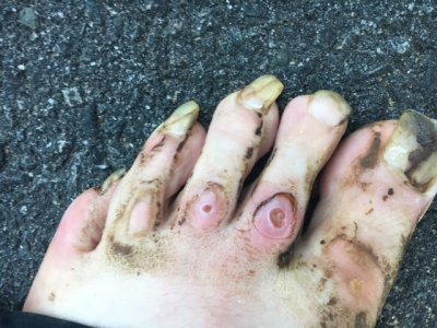 lucas_neglected_feet_christmas_2016