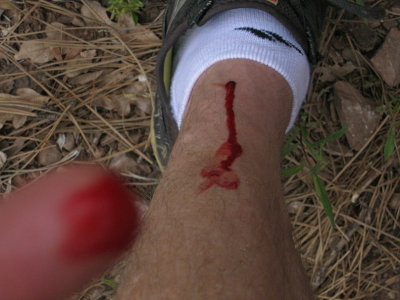 Prickly plant gets its revenge