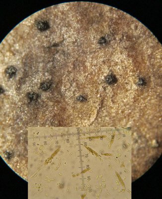 Cryptovalsa protracta with multi-spored asci & spores on ash twig CarltonWood Feb-14 HW m.jpg