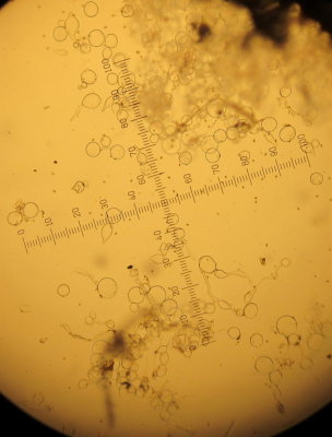 Coprinellus domesticus 2015-04-25 002 cap scale cells.JPG