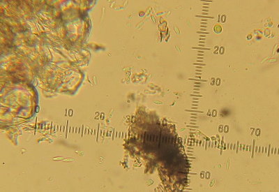 Diaporthe circumscripta 2015-5-24 002Phomopsis biguttulate conidia HW.jpg