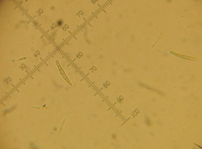Leptosphaeria ogilviensis 2015-5-16 003 5-septate ascospores.JPG