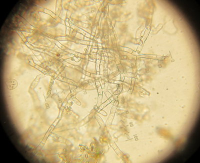 Botryobasidium obtusisporum 004 clampless hyphae Spalford Warren NR Notts 2015-11-15.jpg