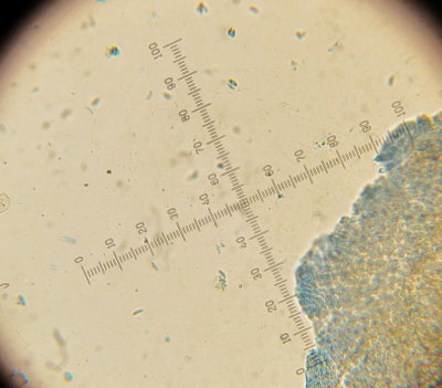 Crepidotus epibryus 003 spores 2015-11-13.jpg