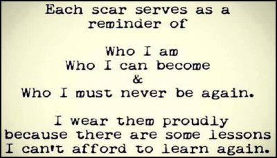 lessons - each scar serves.jpg