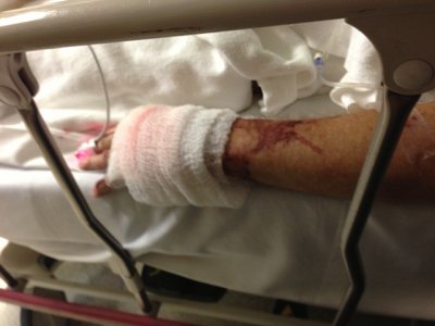 Loose bandages until they can do a detail assessment.