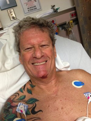 I looked like shit - but with that much morphine... who gives a shit!