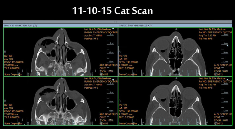 Cat scans12ps PF.jpg