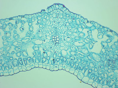 Lily Leaf, Light Field, 200x (cross section)