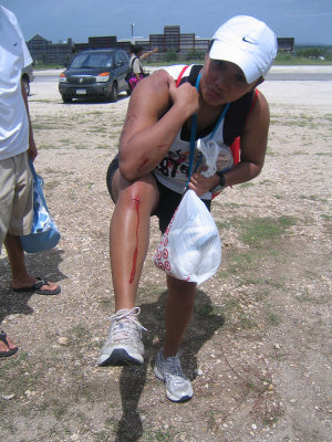 Battle Wounds
