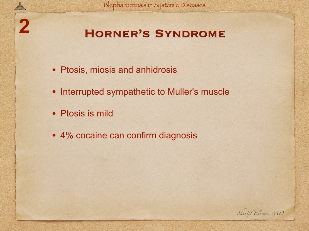 Blepharoptosis in Systemic Diseases.017.jpeg