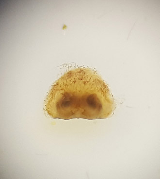 Subbe Halland 25.7-17 epigyn adult female