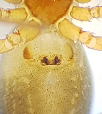 Oedothorax fuscus ( Markballongspindel )