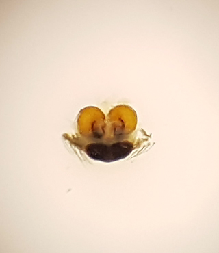 Ravlunda Skne 5.5 vulva adult female