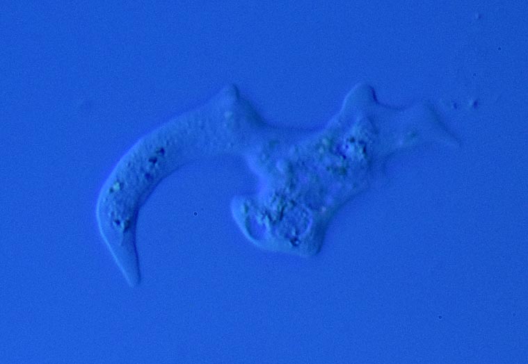 40x DIC amoeba.jpg