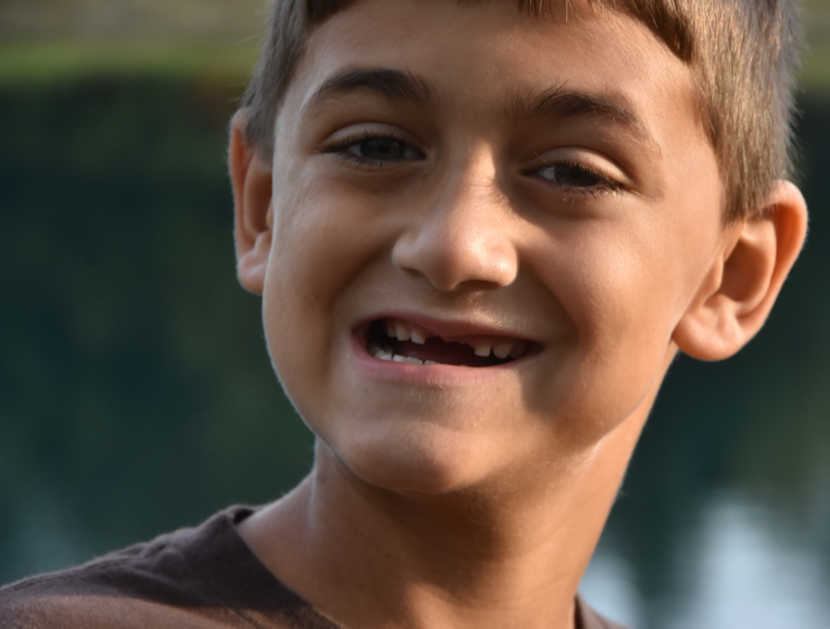 AJ with his missing front teeth
