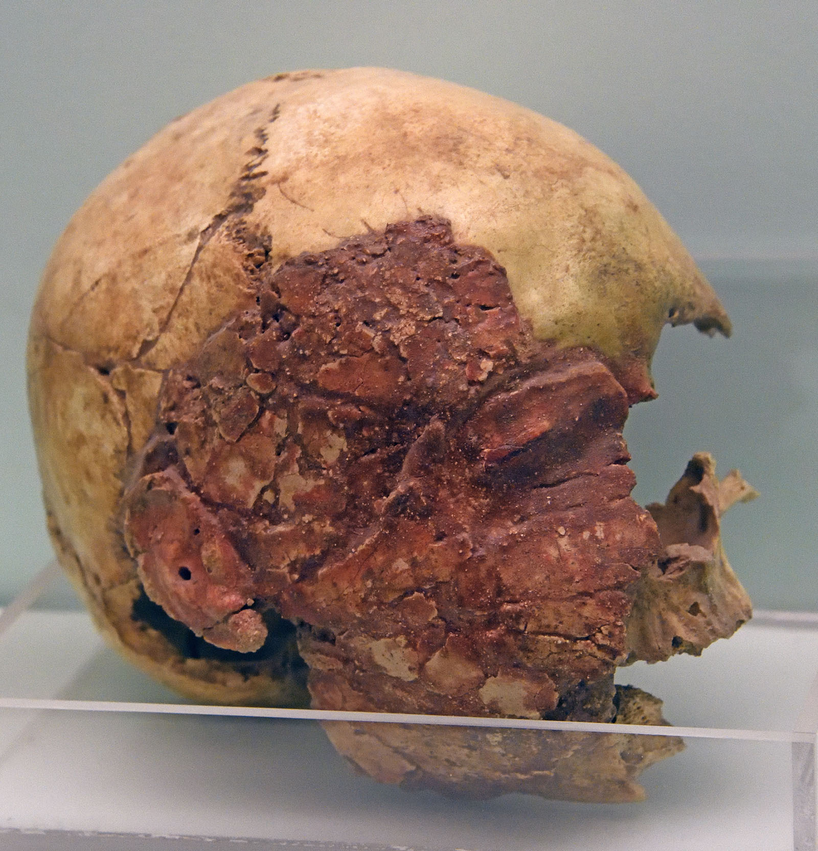 Nigde museum Kosk Hoyuk skull 0878.jpg