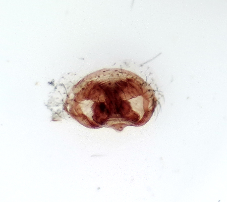 Stensa Halland 5.4-19 epigyn adult female