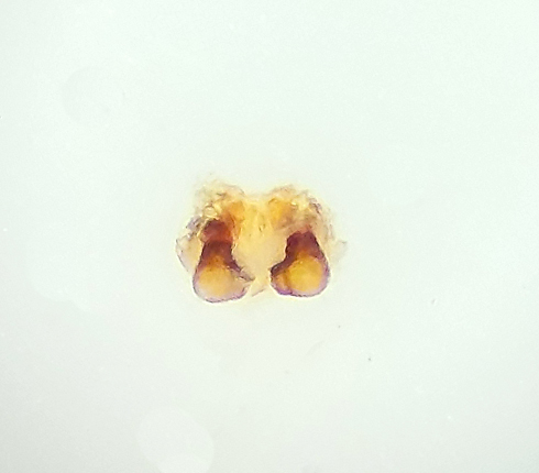 Nackhlle Halland 30.3-24 vulva adult female
